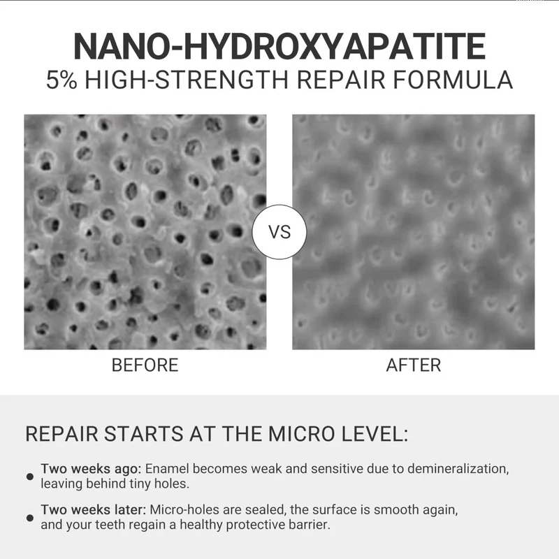 Dentifrice solide à la nano-hydroxyapatite 5 %