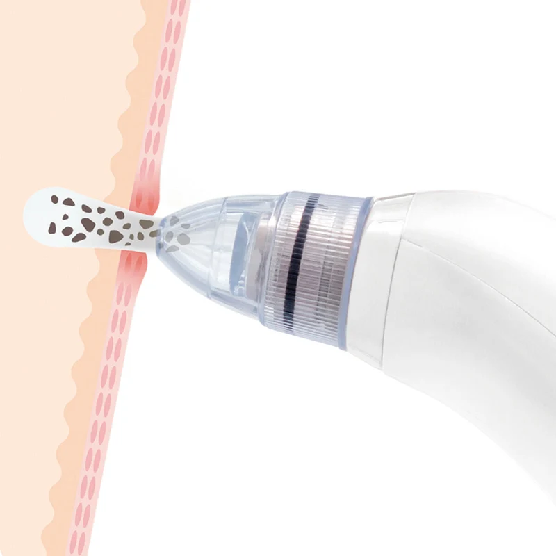 ASPIRATEUR DE SÉBUM ( Rechargeable )