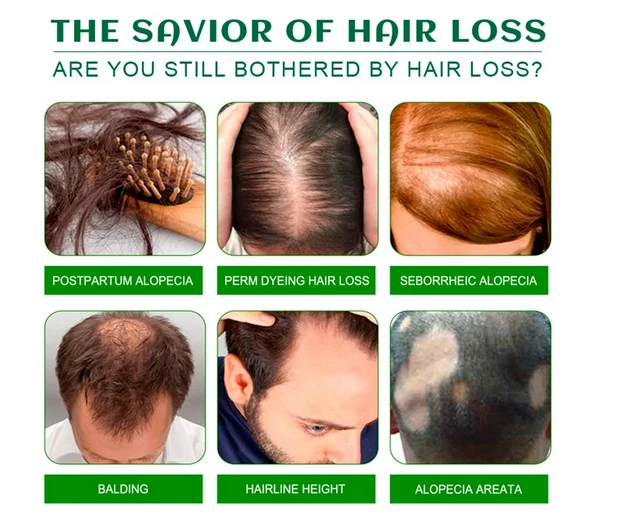 DISAAR HAIR OFFRE SPECIAL