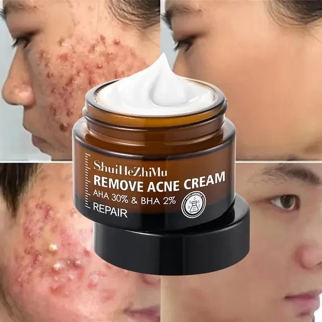 Crème au Rétinol Anti-Âge 1 acheter = 1 offert