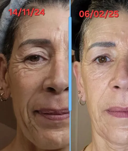 Crème au Rétinol Anti-Âge 1 acheter = 1 offert