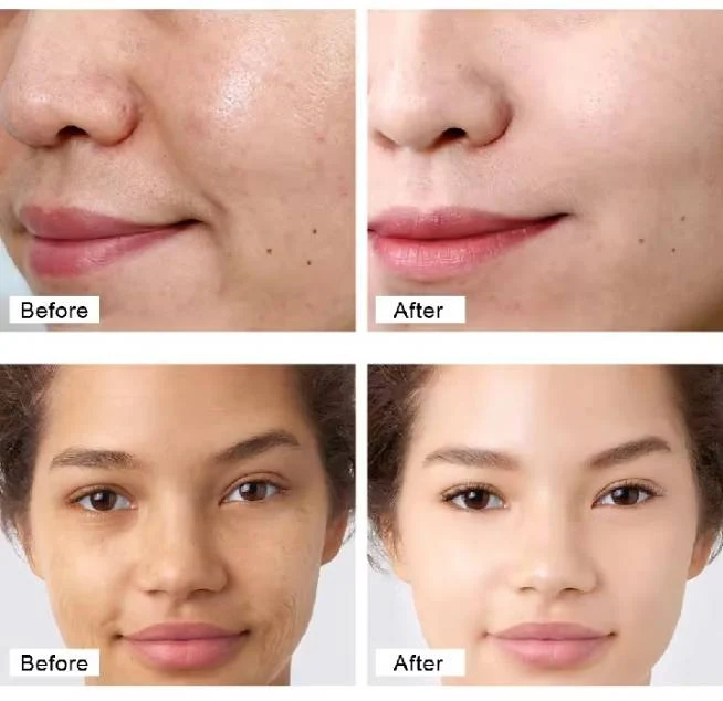 Crème au Rétinol Anti-Âge 1 acheter = 1 offert