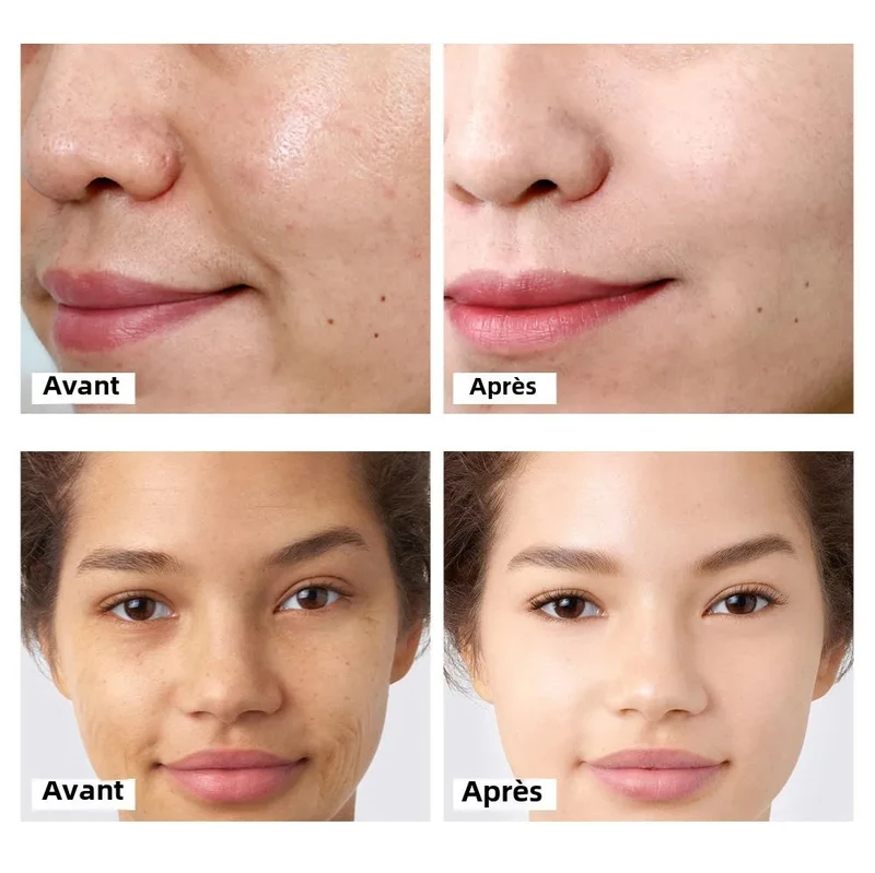 CREME ANTI AGE